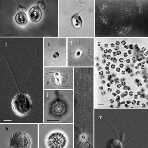  ハプトゾア、この単細胞生物は本当に「ハプ」と「ゾア」でできたのか？