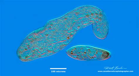  Xenosporina!  A Tiny Ciliate That Makes Its Home In A Whole Other Creature